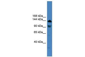WB Suggested Anti-TLR8 Antibody Titration: 0. (TLR8 antibody  (C-Term))