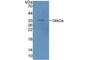 Figure. (PCDH15 antibody  (AA 45-270))