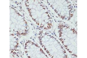 Immunohistochemistry of paraffin-embedded Human colon using Phospho-POLR2A(S5) Polyclonal Antibody at dilution of 1:100 (40x lens). (POLR2A/RPB1 antibody  (pSer5))