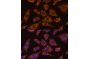 Immunofluorescence analysis of L929 cells using PREPL Polyclonal Antibody (ABIN7269561) at dilution of 1:100 (40x lens). (PREPL antibody  (AA 578-727))