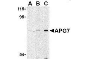 AP20056PU-N ATG7 antibody staining of L1210 cell lysate by Western Blotting at (A) 1, (B) 2 and (C) 4 μg/ml. (ATG7 antibody  (N-Term))