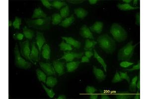Immunofluorescence of monoclonal antibody to GLS on HeLa cell. (Glutaminase antibody  (AA 580-669))
