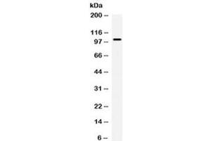 Western blot testing of human COLO320 cell lysate with Calpastatin antibody at 0.