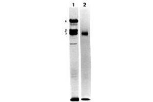 Immunoprecipitation of the culture medium of human pancreatic carcinoma cells (metabolically labeled with S35Ðmethionine) with MAb BC17 (Laminin g1) (Lane 1).