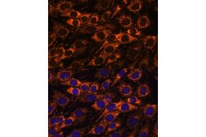Immunofluorescence analysis of C6 cells using  antibody (ABIN7265368) at dilution of 1:100. (ACAA2 antibody  (AA 1-250))