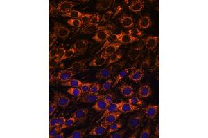 Immunofluorescence analysis of C6 cells using  antibody (ABIN7265368) at dilution of 1:100. (ACAA2 antibody  (AA 1-250))
