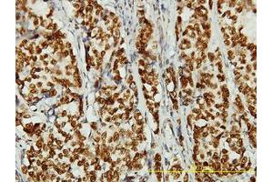 Image no. 1 for anti-Non-SMC Condensin II Complex, Subunit D3 (NCAPD3) (AA 1-341) antibody (ABIN466186) (NCAPD3 antibody  (AA 1-341))