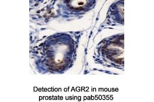 Image no. 2 for anti-Anterior Gradient Homolog 2 (Xenopus Laevis) (AGR2) (AA 50-100) antibody (ABIN363664) (AGR2 antibody  (AA 50-100))