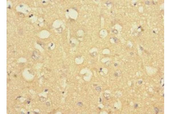 LRRC4C antibody  (AA 201-500)