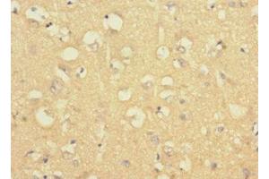 Immunohistochemistry of paraffin-embedded human brain tissue using ABIN7158190 at dilution of 1:100