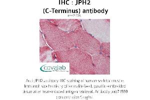 Image no. 2 for anti-Junctophilin 2 (JPH2) (C-Term) antibody (ABIN1736131) (Junctophilin 2 antibody  (C-Term))