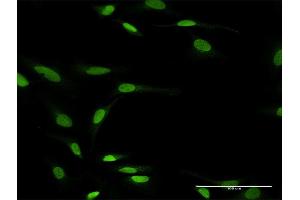 Immunofluorescence of purified MaxPab antibody to ZNF71 on HeLa cell. (ZNF71 antibody  (AA 1-489))