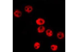 ABIN6274019 staining Hela by IF/ICC. (ID1 antibody  (Internal Region))