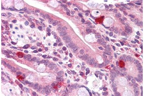 PPAPDC2 antibody  (C-Term)