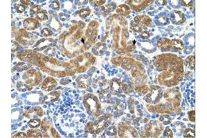 ATIC antibody was used for immunohistochemistry at a concentration of 4-8 ug/ml. (ATIC antibody  (Middle Region))