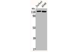 Western Blot analysis of Jurkat A549 cells using GCP5 Polyclonal Antibody (TUBGCP5 antibody  (Internal Region))