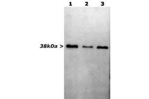 Sciatic nerves of mouse wild type (1), heterozygous (2) and homozygous (3) for knock out of peripheral myelin protein 21 (pmp21) were homogenized in SDS-PAGE sample buffer and run out for western blots.
