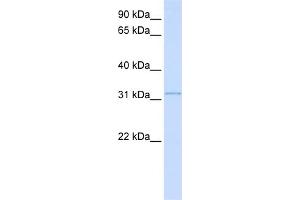 WB Suggested Anti-SUSD4 Antibody Titration:  0. (SUSD4 antibody  (N-Term))