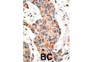 Immunohistochemistry (IHC) image for anti-RAD9 Homolog A (S. Pombe) (RAD9A) (BH3 Domain) antibody (ABIN2997201) (RAD9A antibody  (BH3 Domain))