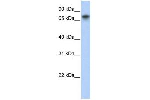 WB Suggested Anti-TRIM29 Antibody Titration:  0. (TRIM29 antibody  (Middle Region))