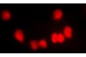 Immunofluorescent analysis of HKR1 staining in NIH3T3 cells. (HKR1 antibody  (Center))