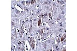 Immunohistochemistry (IHC) image for anti-Interleukin 16 (IL16) (N-Term) antibody (ABIN1031693) (IL16 antibody  (N-Term))