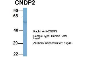 Host: Rabbit  Target Name: CNDP2  Sample Tissue: Human Fetal Heart  Antibody Dilution: 1. (CNDP2 antibody  (Middle Region))