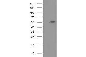 HEK293T cells were transfected with the pCMV6-ENTRY control (Left lane) or pCMV6-ENTRY TP53 (Right lane) cDNA for 48 hrs and lysed. (p53 antibody)