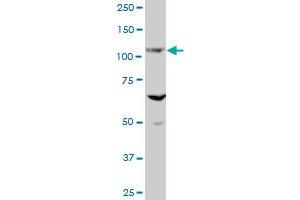 EVC MaxPab polyclonal antibody. (EVC antibody  (AA 1-535))