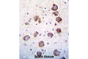 Immunohistochemistry (Paraffin-embedded Sections) (IHC (p)) image for anti-Epidermal Growth Factor (EGF) (AA 689-720), (Middle Region) antibody (ABIN952036)
