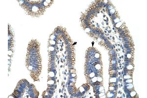 Human Intestine (CTNNB1 antibody  (C-Term))