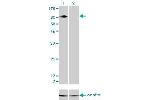 Western blot analysis of ITGB5 over-expressed 293 cell line, cotransfected with ITGB5 Validated Chimera RNAi (Lane 2) or non-transfected control (Lane 1). (Integrin beta 5 antibody  (AA 421-516))