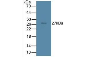 Western blot analysis of Rat Spleen Tissue. (TMEM27 antibody  (Leu222))