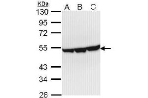 WB Image Sample (30 ug of whole cell lysate) A: Hep G2 , B: Molt-4 , C: Raji 10% SDS PAGE antibody diluted at 1:1000 (ENO3 antibody)