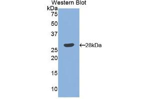 Western blot analysis of the recombinant protein. (Angiopoietin 1 antibody  (AA 266-497))