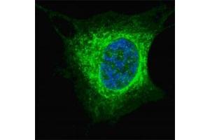 Fluorescent confocal image of SY5Y cells stained with Vimentin antibody at 1:200. (Vimentin antibody  (AA 63-90))