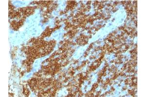 Formalin-fixed, paraffin-embedded human tonsil stained with CD45RA Mouse Monoclonal Antibody (111-1C5) (CD45 antibody)