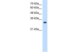 Western Blotting (WB) image for anti-Solute Carrier Family 7 (Amino Acid Transporter, L-Type), Member 8 (SLC7A8) antibody (ABIN2462749) (SLC7A8 antibody)