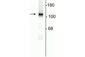 Western blot of 10 µg of rat hippocampal lysate showing specific immunolabeling of the ~120 kDa NR1 subunit of the NMDA receptor. (GRIN1/NMDAR1 antibody  (AA 1-564))