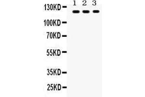 Anti- TLR7 Picoband antibody, Western blottingAll lanes: Anti TLR7  at 0. (TLR7 antibody  (C-Term))
