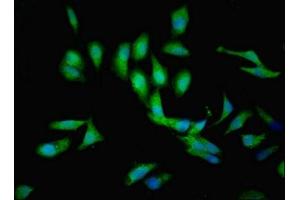 Immunofluorescent analysis of Hela cells using ABIN7146153 at dilution of 1:100 and Alexa Fluor 488-congugated AffiniPure Goat Anti-Rabbit IgG(H+L) (C1GALT1C1 antibody  (AA 30-190))