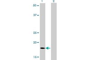 Western Blot analysis of RNF181 expression in transfected 293T cell line by RNF181 monoclonal antibody (M01), clone 5A7. (RNF181 antibody  (AA 90-153))