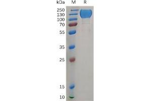 SDS-PAGE (SDS) image for C-Mer Proto-Oncogene Tyrosine Kinase (MERTK) (AA 21-505) protein (Fc Tag) (ABIN6964292)