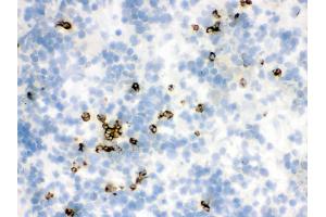 Immunohistochemistry (IHC) image for anti-Lipocalin 2 (LCN2) (AA 21-198) antibody (ABIN3043291)