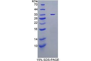 SDS-PAGE analysis of Mouse TP Protein. (Thymidine Phosphorylase Protein (TYMP))