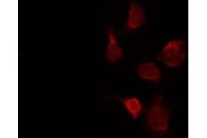 ABIN6273991 staining Hela by IF/ICC. (TUBA4A antibody  (N-Term))