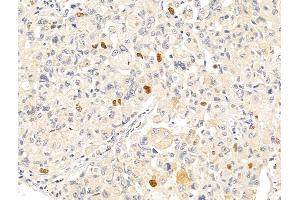 Anillin Antibody at 1/100 staining Rat stomach tissue by IHC-P.