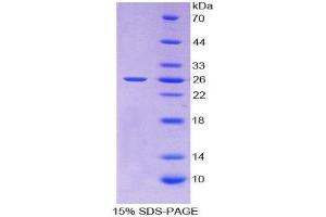 SDS-PAGE (SDS) image for TIMP Metallopeptidase Inhibitor 3 (TIMP3) (AA 26-211) protein (His tag) (ABIN1980672)