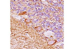 Human cerebellum stained with Neurofilament antibody (NF421). (Neurofilament antibody)