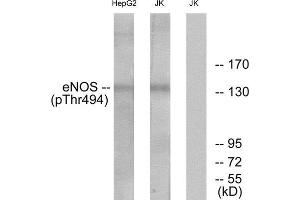 Western Blotting (WB) image for anti-Nitric Oxide Synthase 3 (Endothelial Cell) (NOS3) (pThr494) antibody (ABIN1847468) (ENOS antibody  (pThr494))